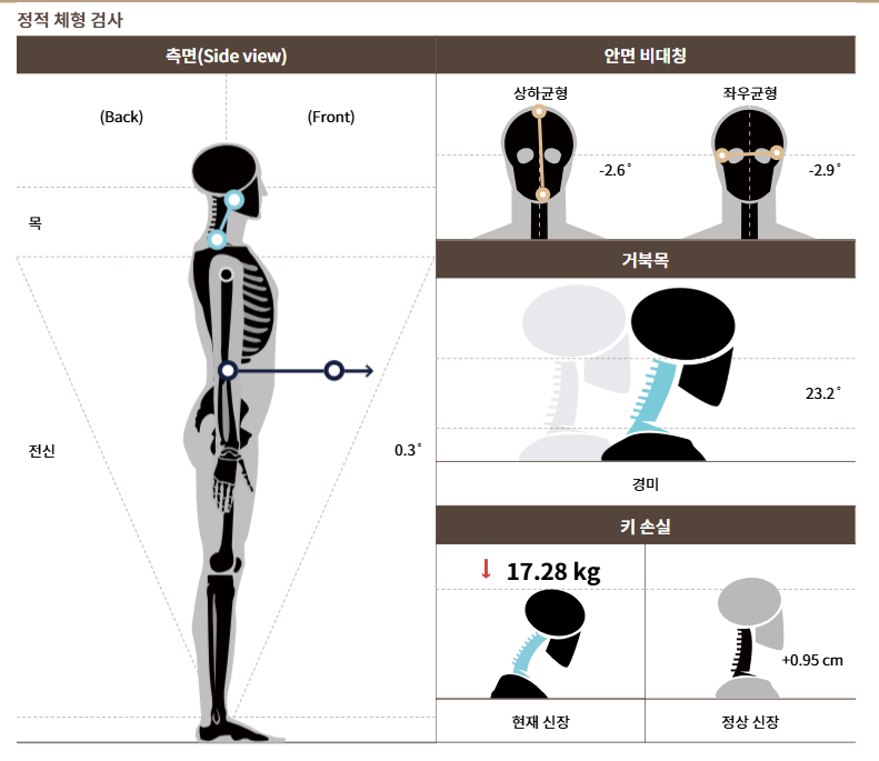 측면 체형분석 예시